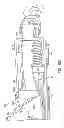 Fig. 15 - Electrically non-conductive calibrated mechanical winch and method of manufacture