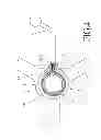 Fig. 05 - ADJUSTABLE STRUCTURE FOR THE FOOTREST RING OF A CHAIR