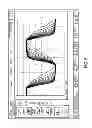 Fig. 06 - Clock feathered slew rate control system