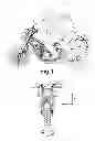 Fig. 02 - Apparatuses, system and process for detecting accidents