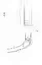 Fig. 06 - Obstacle detection device for vehicle