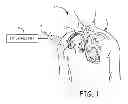 Fig. 02 - TRIM ALGORITHM FOR A MEDICAL DEVICE ANTENNA