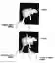 Fig. 01 - MEDICAL IMAGE DISPLAY APPARATUS, METHOD AND PROGRAM