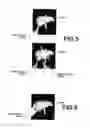 Fig. 04 - MEDICAL IMAGE DISPLAY APPARATUS, METHOD AND PROGRAM