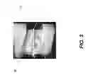 Fig. 06 - Imaging apparatus for display of maxillary and mandibular arches