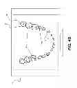Fig. 08 - Imaging apparatus for display of maxillary and mandibular arches