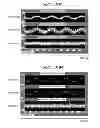 Fig. 20 - Control device, actuator including control device, image blur correction device, interchangeable lens, image pickup apparatus, and automatic stage