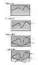 Fig. 07 - Apparatus and method for reconstructing complex salt geometry using dual-flood RTM with prismatic waves