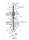 Fig. 10 - Sensor system for bottom electrodes of an electric arc furnace