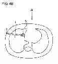 Fig. 07 - X-RAY CT APPARATUS, X-RAY CT SYSTEM
