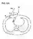Fig. 22 - X-RAY CT APPARATUS, X-RAY CT SYSTEM