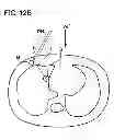 Fig. 23 - X-RAY CT APPARATUS, X-RAY CT SYSTEM