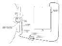 Fig. 01 - Bone-conduction pickup transducer for microphonic applications