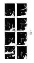 Fig. 07 - Methods, systems, and media for generating and analyzing medical images having elongated structures