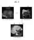 Fig. 09 - Method and apparatus for medical image registration