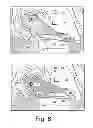 Fig. 09 - Turbine wastegate