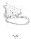 Fig. 07 - Turbine wastegate