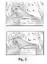 Fig. 09 - Turbine wastegate