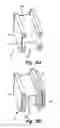 Fig. 06 - Gas turbine engine synchronizing ring with multi-axis joint