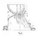 Fig. 06 - Wind turbine rotor and method of mounting