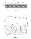 Fig. 06 - Attachment system for a wind turbine rotor blade accessory