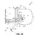 Fig. 04 - Ceramic and refractory metal core assembly