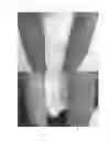 Fig. 02 - Method for treating dermatitis and improving skin texture using natriuretic peptides