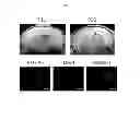 Fig. 02 - Composition for treating intraventricular hemorrhage in preterm infants comprising mesenchymal stem cells