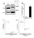 Fig. 04 - COMPOSITIONS AND METHODS FOR THE TREATMENT OF KRABBE AND OTHER NEURODEGENERATIVE DISEASES