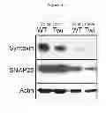 Fig. 05 - COMPOSITIONS AND METHODS FOR THE TREATMENT OF KRABBE AND OTHER NEURODEGENERATIVE DISEASES