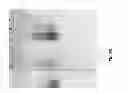 Fig. 04 - CORRECTLY FOLDED ETANERCEPT IN HIGH PURITY AND EXCELLENT YIELD