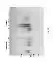 Fig. 06 - CORRECTLY FOLDED ETANERCEPT IN HIGH PURITY AND EXCELLENT YIELD