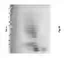 Fig. 08 - CORRECTLY FOLDED ETANERCEPT IN HIGH PURITY AND EXCELLENT YIELD