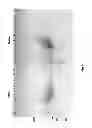 Fig. 09 - CORRECTLY FOLDED ETANERCEPT IN HIGH PURITY AND EXCELLENT YIELD
