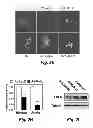 Fig. 05 - NOVEL TARGETS FOR TREATMENT OF HYPERCHOLESTEROLEMIA