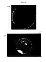 Fig. 07 - BIOABSORBABLE TRACHEAL STENT, AND METHOD OF MANUFACTURING THEREOF