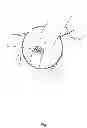 Fig. 08 - Rolled collagen carrier