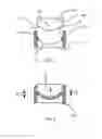 Fig. 03 - Process for manufacturing an ophthalmic lens