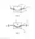 Fig. 04 - Process for manufacturing an ophthalmic lens