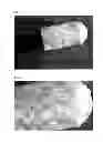 Fig. 02 - Biphasic collagen membrane or capsule for guided tissue regeneration