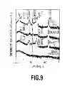 Fig. 10 - Perpendicular magnetic recording medium and method for manufacturing the same