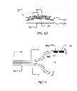 Fig. 04 - Flexible fuel cell structures having external support