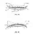 Fig. 05 - Flexible fuel cell structures having external support