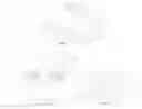Fig. 02 - Pearlescent white aligners
