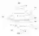 Fig. 02 - Adjustable mandibular advancement device