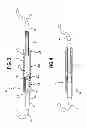 Fig. 03 - Orthodontic appliance having sliding rods