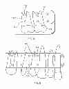 Fig. 04 - INTRA-ORAL LIGHT THERAPY APPARATUSES AND METHODS FOR THEIR USE