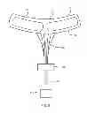 Fig. 07 - INTRA-ORAL LIGHT THERAPY APPARATUSES AND METHODS FOR THEIR USE