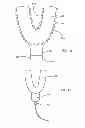 Fig. 12 - INTRA-ORAL LIGHT THERAPY APPARATUSES AND METHODS FOR THEIR USE