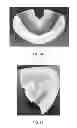 Fig. 19 - INTRA-ORAL LIGHT THERAPY APPARATUSES AND METHODS FOR THEIR USE